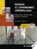 Ataxies et syndromes cérébelleux