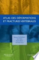 Atlas des déformations et fractures vertébrales