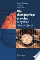 Atlas photographique en couleur du système nerveux central