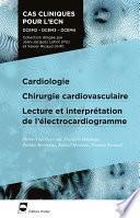 Cardiologie - Chirurgie cardiovasculaire - Lecture et interprétation de l'électrocardiogramme