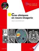 Cas cliniques en neuro-imagerie