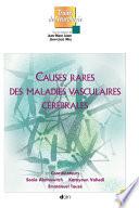Causes rares des maladies vasculaires cérébrales