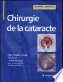 Chirurgie de la cataracte