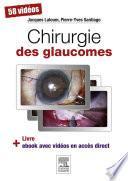 Chirurgie des glaucomes