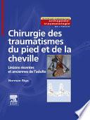 Chirurgie des traumatismes du pied et de la cheville