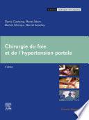 Chirurgie du foie et de l'hypertension portale