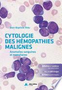 Cytologie des hémopathies malignes