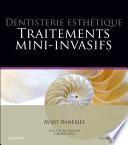 Dentisterie esthétique : traitements mini-invasifs