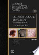 Dermatologie et infections sexuellement transmissibles