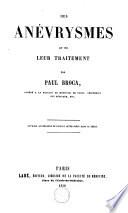 Des anévrysmes et de leur traitement