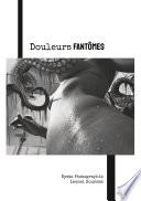 Douleurs fantômes