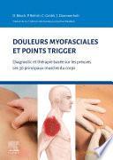 Douleurs myofasciales et points trigger