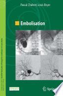 Embolisation