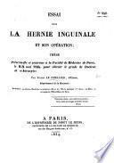 Essai sur la hernie inguinale et son opération; thèse, etc