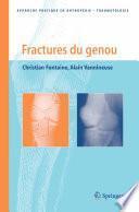 Fractures du genou