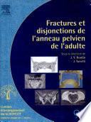 Fractures et disjonctions de l'anneau pelvien de l'adulte
