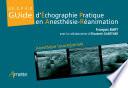 Guide d'échographie pratique en anesthésie-réanimation