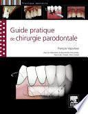 Guide pratique de chirurgie parodontale