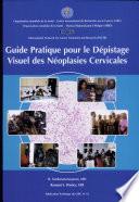 Guide pratique pour le dépistage visuel des néoplasies cervicales