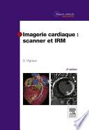 Imagerie cardiaque : scanner et IRM