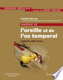 Imagerie de l'oreille et de l'os temporal - Volume 4 : Tumeurs, nerf facial