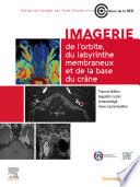 Imagerie de l’orbite, du labyrinthe membraneux et de la base du crâne