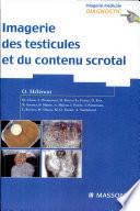 Imagerie des testicules et du contenu scrotal