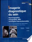 Imagerie diagnostique du sein