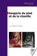 Imagerie du pied et de la cheville