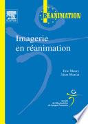 Imagerie en réanimation