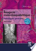 Imagerie musculosquelettique : pathologies générales