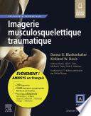 Imagerie musculosquelettique traumatique
