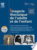 Imagerie thoracique de l'enfant et de l'adulte