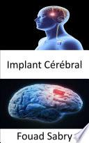 Implant Cérébral