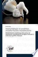 Implantologie et prothèse maxillo-faciale mandibulaire