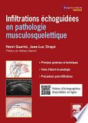 Infiltrations échoguidées