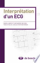 Interprétation d'un ECG