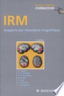 IRM