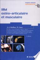 IRM ostéo-articulaire et musculaire