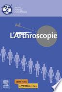 L'arthroscopie