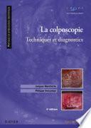 La colposcopie