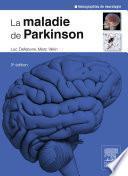 La maladie de Parkinson
