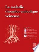 La maladie thrombo-embolique veineuse