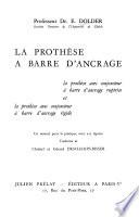 La prothèse à barre d'ancrage