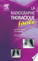 La radiographie thoracique facile