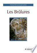 Les brûlures