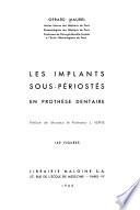 Les implants sous-périostés en prothèse dentaire