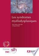LES SYNDROMES MYELODYSPLASIQUES