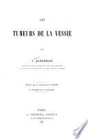 Les tumeurs de la vessie