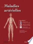 Maladies artérielles